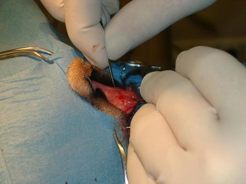 Operace vyhřezlé slzné žlázy třetího víčka
