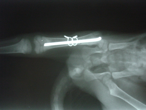 Fraktura stehenní kosti kotěte po operaci1